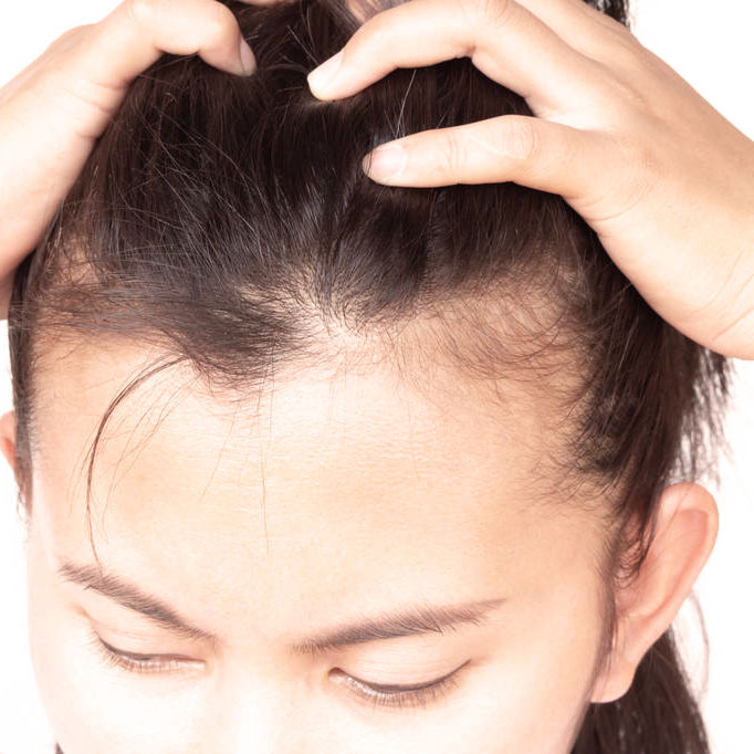 Come risolvere il problema del diradamento e caduta dei capelli dopo il parto